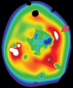XMM-Newton image of galaxy cluster RXCJ0658.5-5556