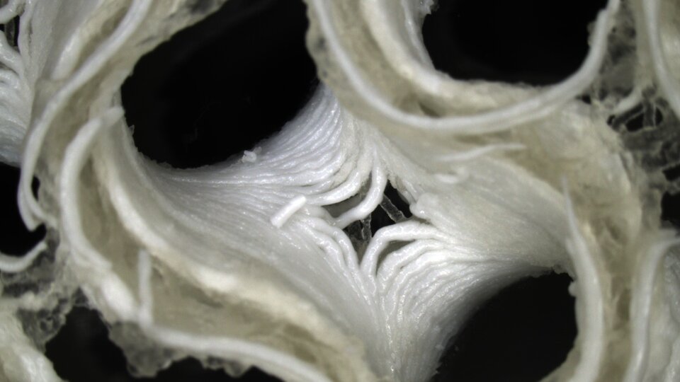 Close-up of growing bone
